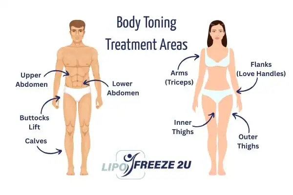 Graphic showing where you can have Body toning Treatment Busby on your body