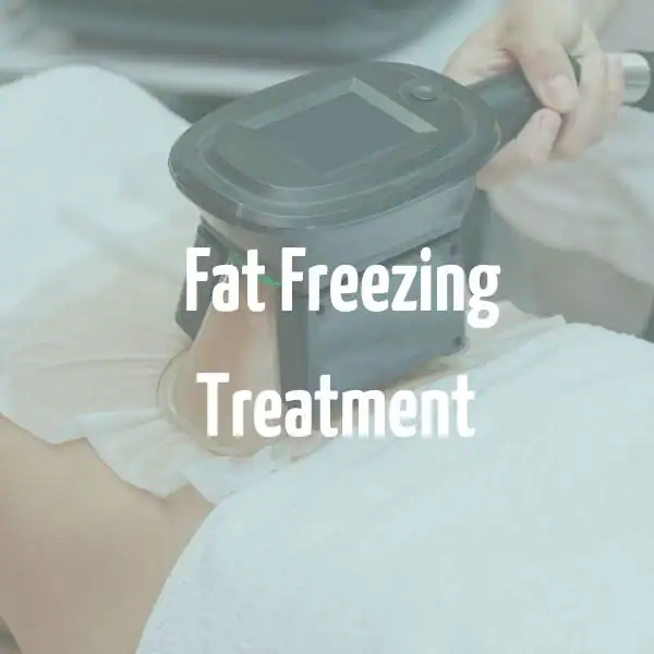 fat freezing treatment Busby